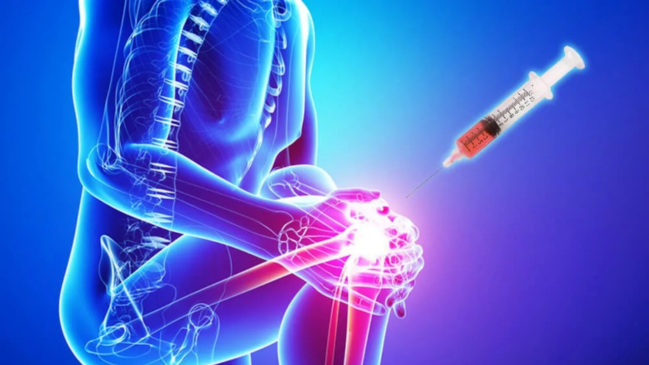 Stem Cell Therapy for Degenerative Disc Disease