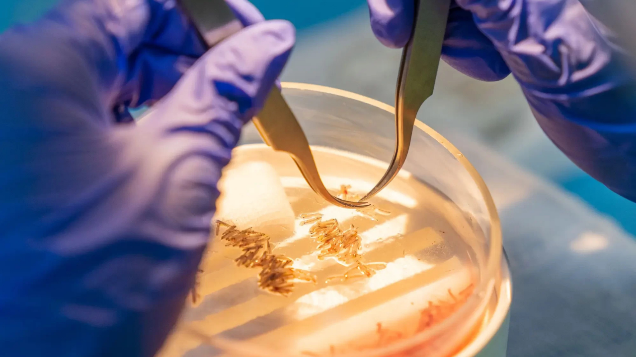 Stem Cell Therapies for Cardiovascular Diseases